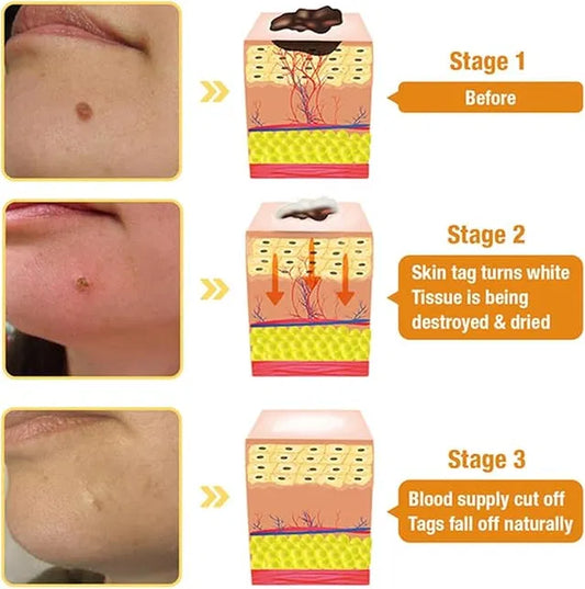 Gold Foil Peel-Off Mask Beilingmei Gold Face Mask for wrinkles (Pack Of 1)