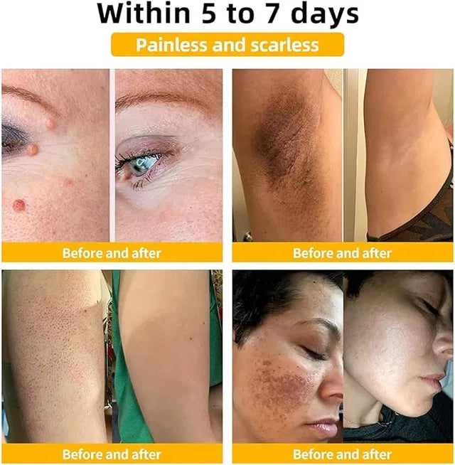 Gold Foil Peel-Off Mask Beilingmei Gold Face Mask for wrinkles (Pack Of 1)